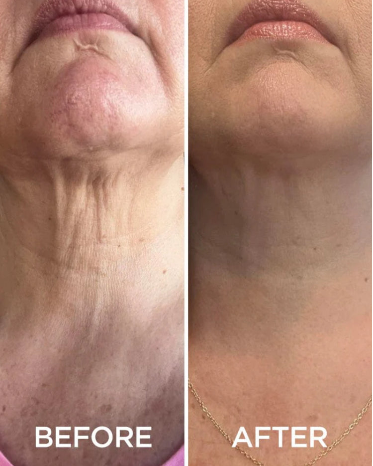 Wrinkle Repair Hydrogel Collagen Neck Mask preventing thermal aging wrinkle improvement
