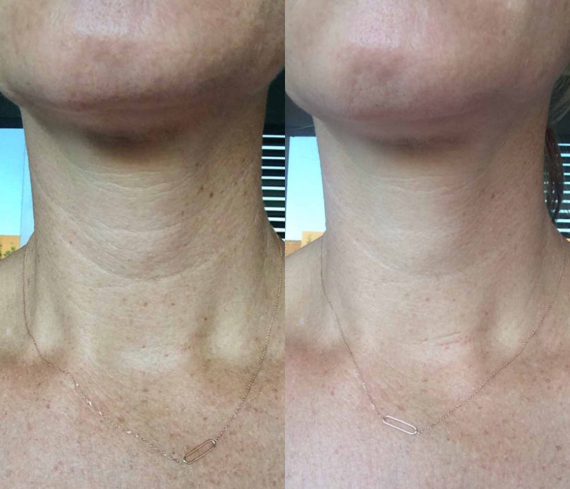Wrinkle Repair Hydrogel Collagen Neck Mask preventing thermal aging wrinkle improvement