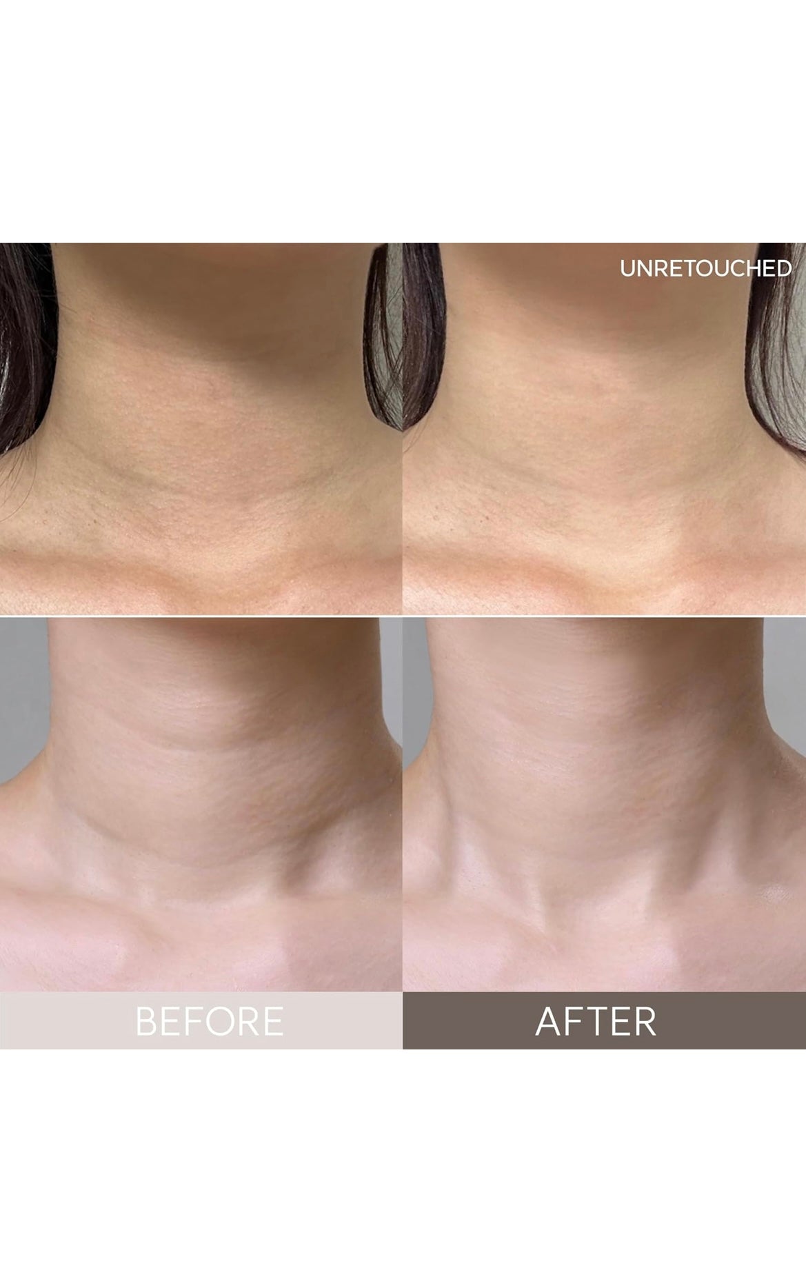 Wrinkle Repair Hydrogel Collagen Neck Mask preventing thermal aging wrinkle improvement