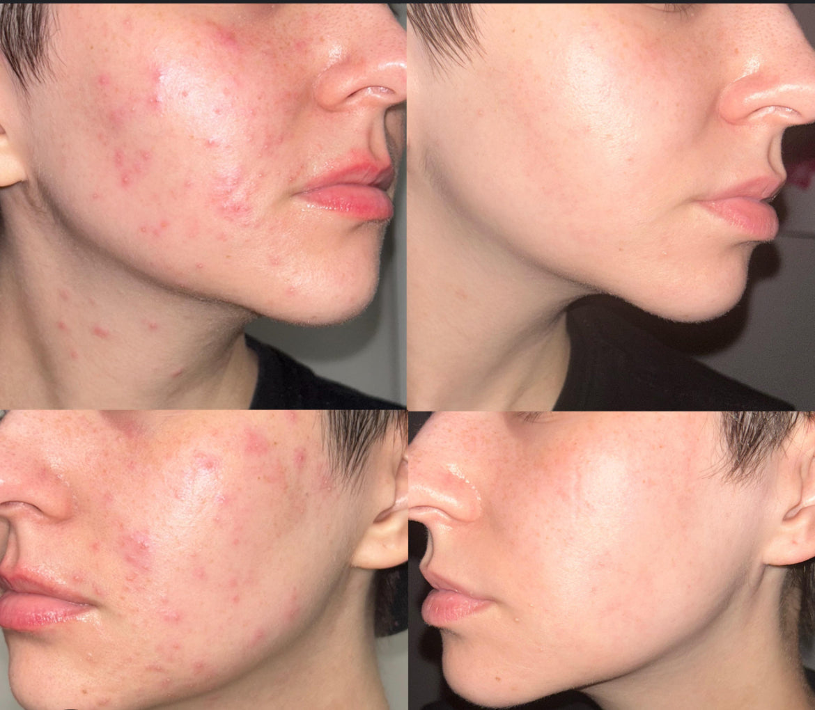 4 in 1 Anti-Aging Anti-Wrinkle Serum