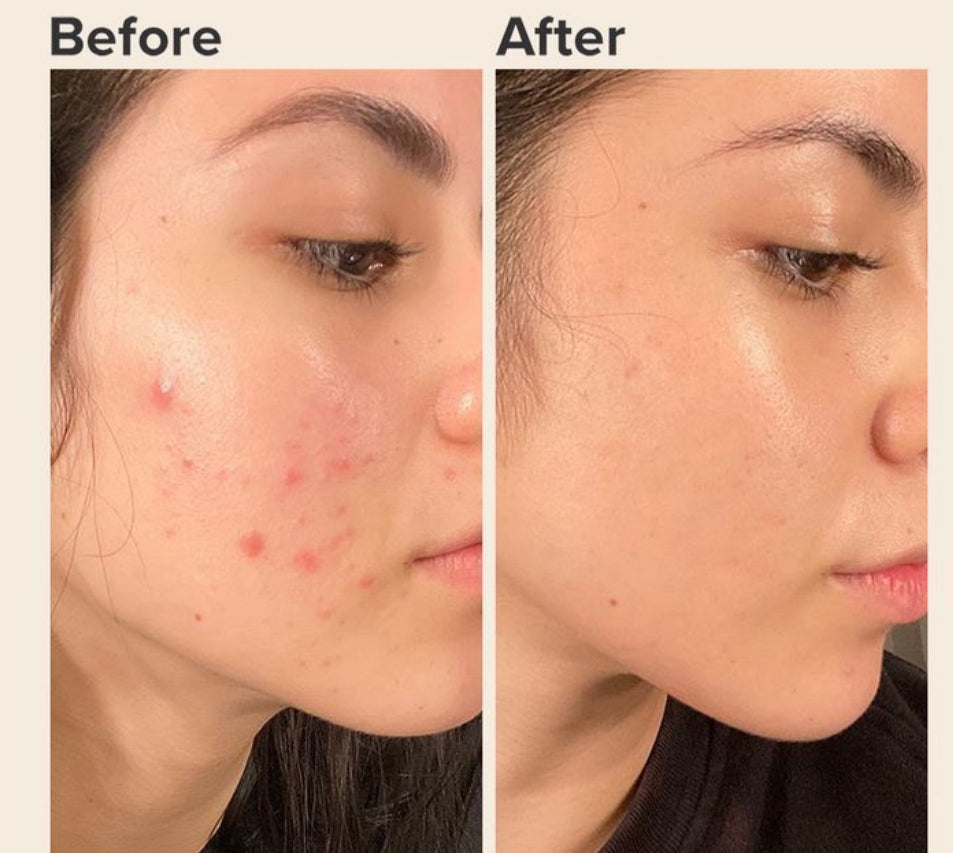 4 in 1 Anti-Aging Anti-Wrinkle Serum
