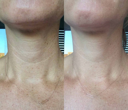 Wrinkle Repair Hydrogel Collagen Neck Mask preventing thermal aging wrinkle improvement