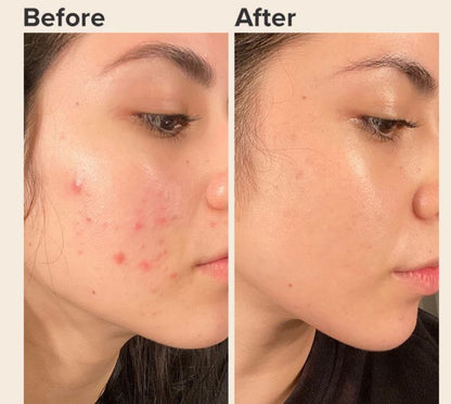 4 in 1 Anti-Aging Anti-Wrinkle Serum